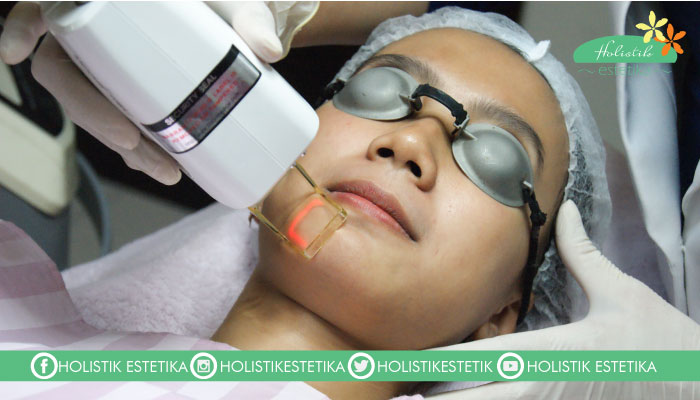 Laser Fractional Resurfacing 1